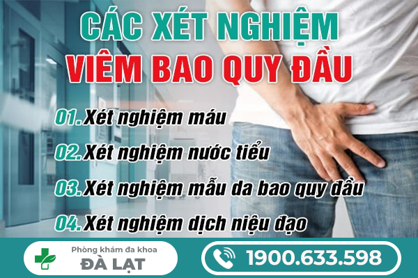 Hình ảnh minh họa